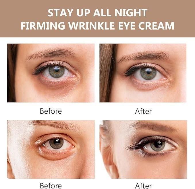 Instant Firmx Eye Bag Cream 🗲 OFFER TODAY